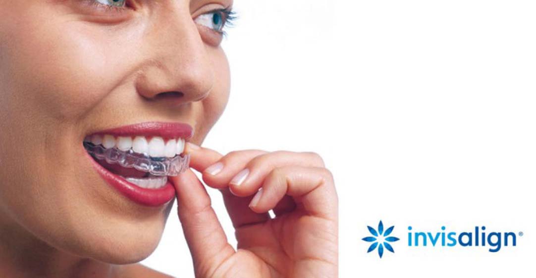 INVISALIGN®